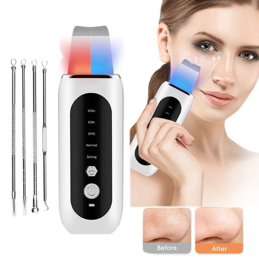 Ultrasonic Face Skin Scrubber